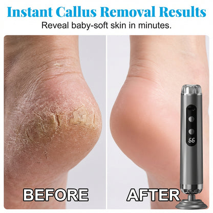 👣 Electric Callus Remover – Reveal Baby-Soft Feet Instantly