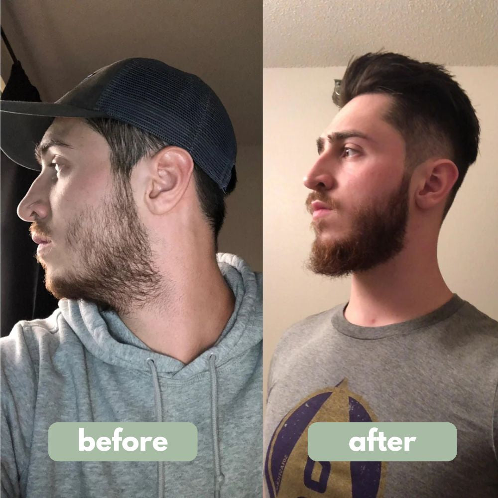 Beard Growth Serum