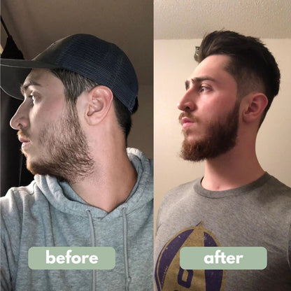 Beard Growth Serum