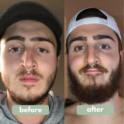 Beard Growth Serum