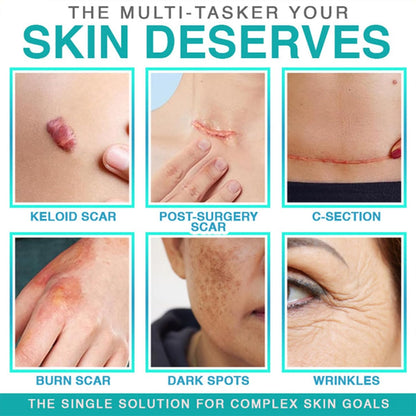 3-in-1 Microneedle Treatment Patch