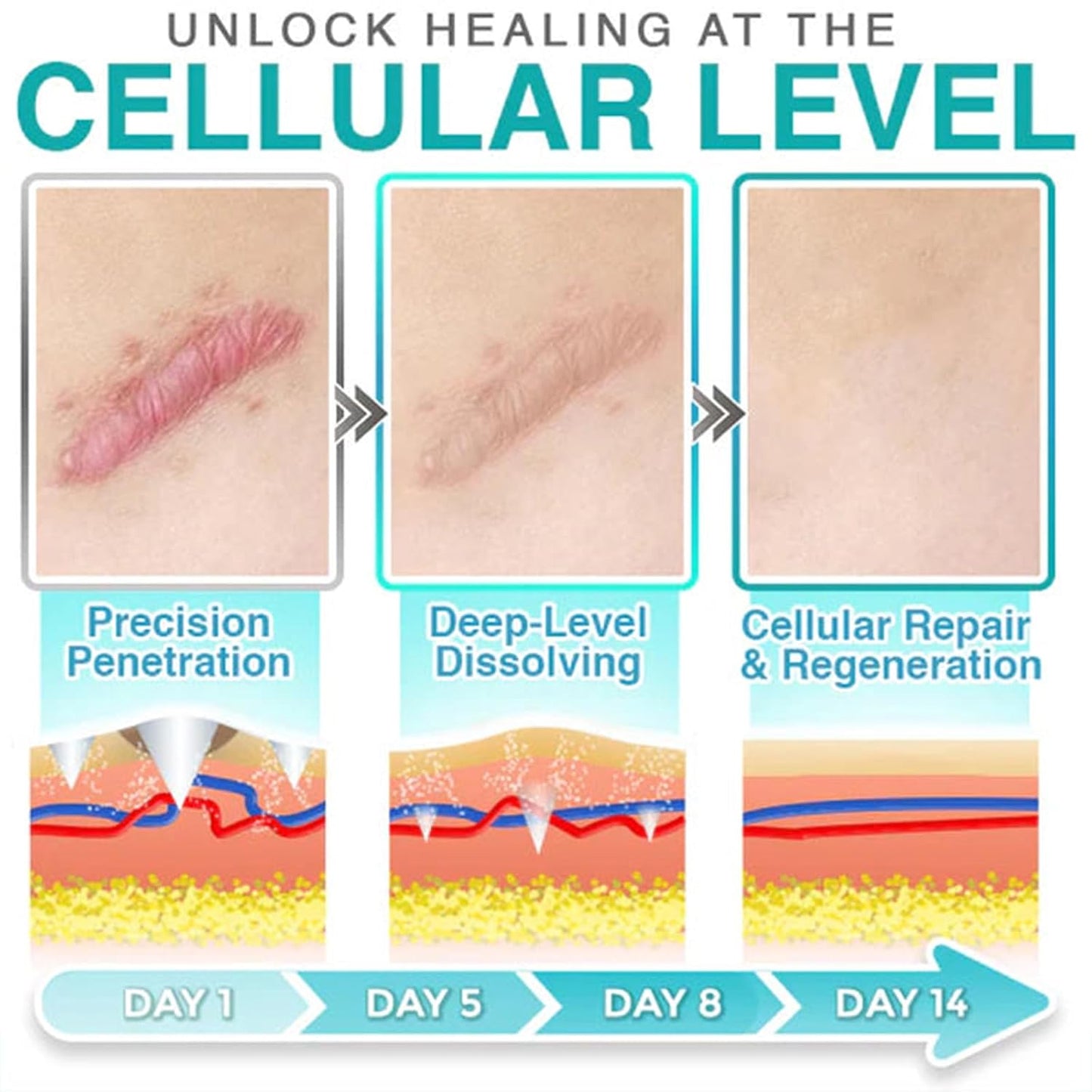 3-in-1 Microneedle Treatment Patch