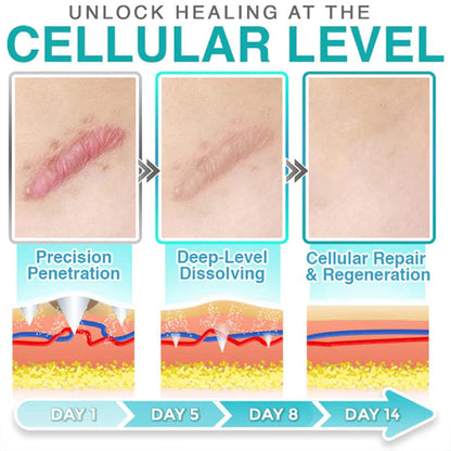 3-in-1 Microneedle Treatment Patch