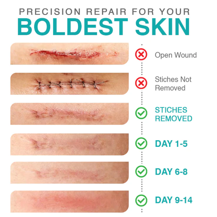3-in-1 Microneedle Treatment Patch