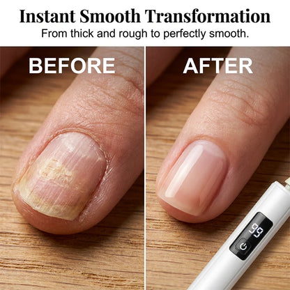 💅✨ Professional Electric Nail Polisher – Smooths thick nails, 99-speed display. Multiple heads for shaping & buffing. Salon at home! 🌟💎